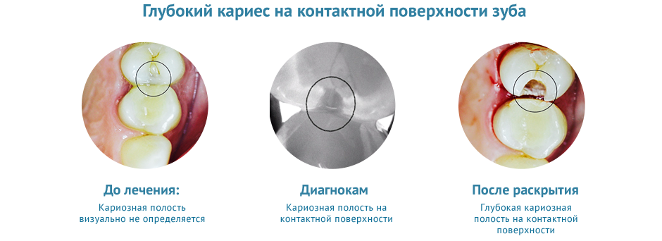 этапы.png этапы.png
